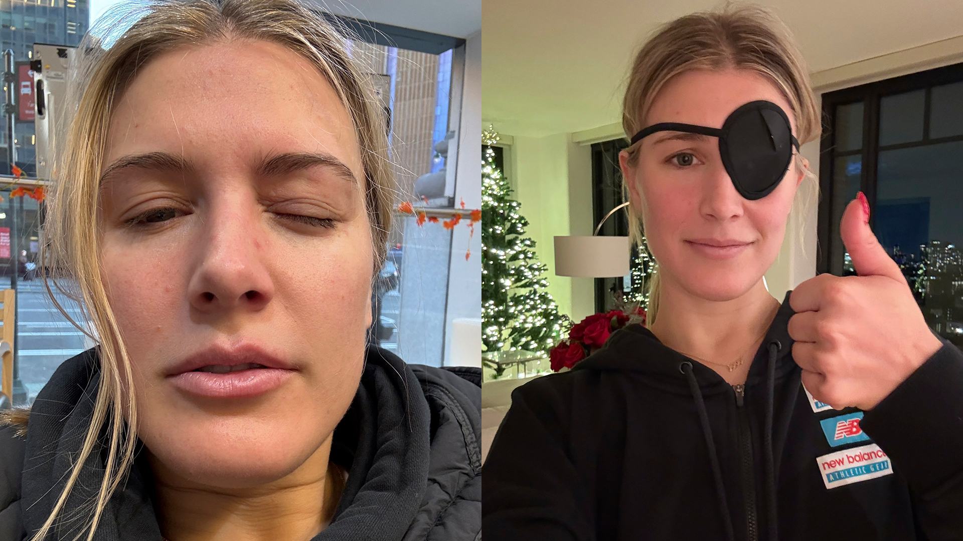 Eugenie Bouchard deli ažuriranje nakon straha od povrede oka tokom treninga pickleball