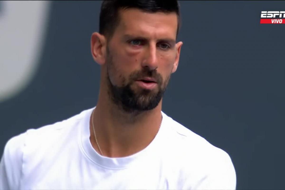 Đoković se pojavljuje sa natečenim okom pred finale Majami Opena