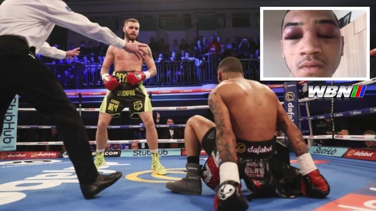 Conor Benn vs Cedrick Peynaud