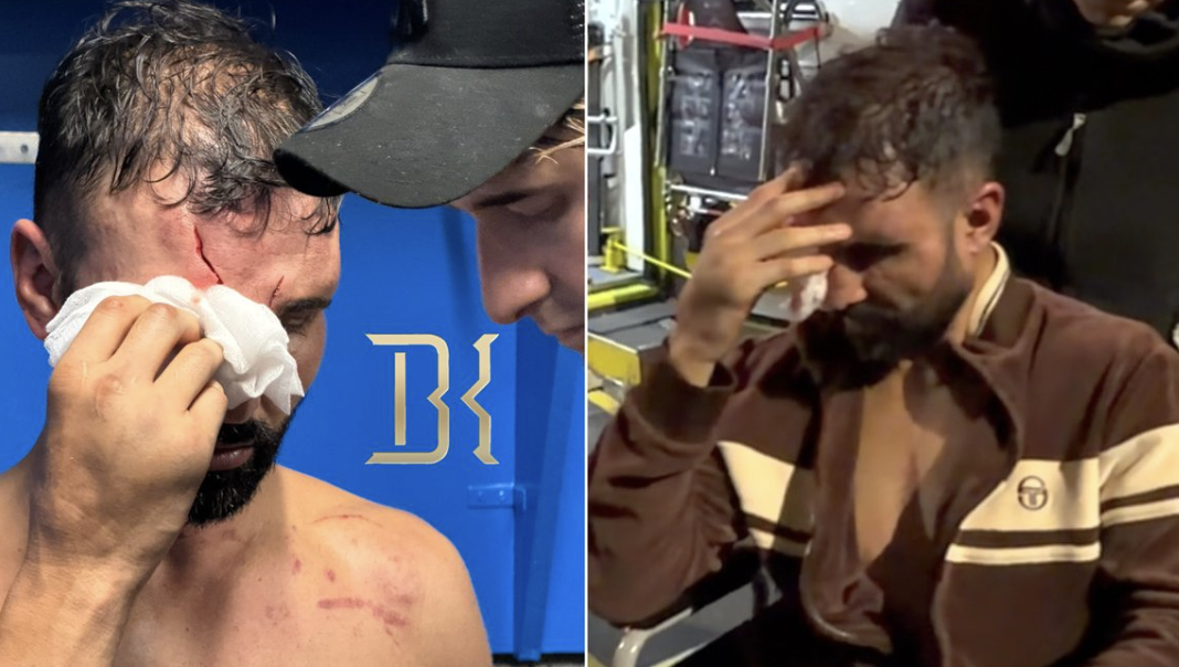Paulie Malignaggi odveden u bolnicu nakon pobede u bokserskom meču golim rukama