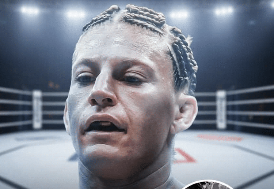 Kejla Harison se bavi operacijom vrata i povlačenjem UFC 324