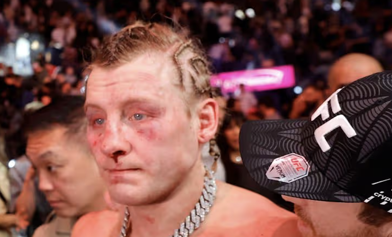 Pimblet se bavi svojim prvim UFC gubitkom