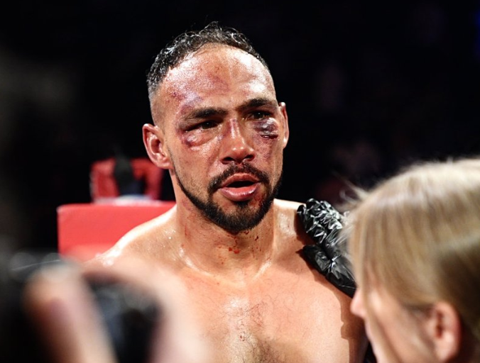 Turman trpi prvi prekid gubitak kao Fundora zadržava VBC titulu