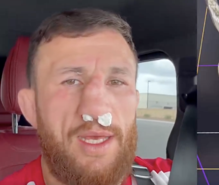 Merab Dvalishvili pretrpio povredu sparinga