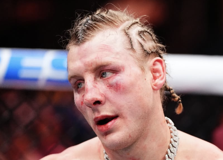 Navike u ishrani Paddija Pimbleta izazivaju zabrinutost